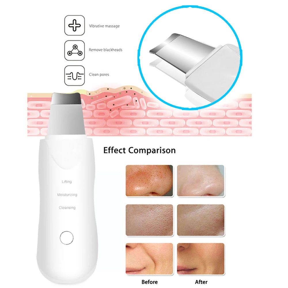 Ultrasonic Skin Scrubber Cleaner