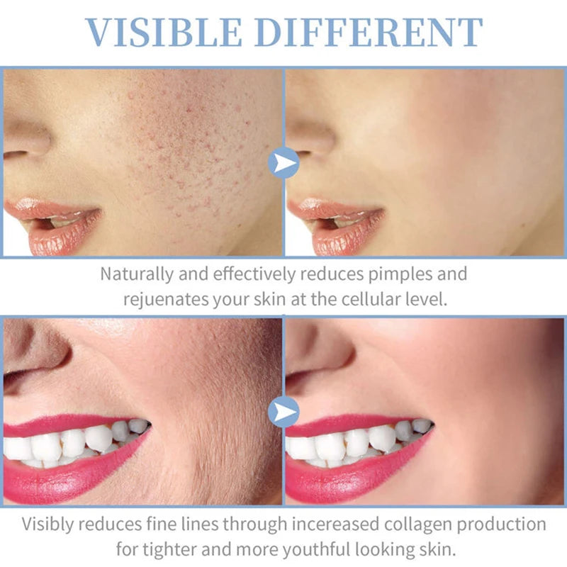 Glow Wand for Skin Therapy, D’Arsonval
