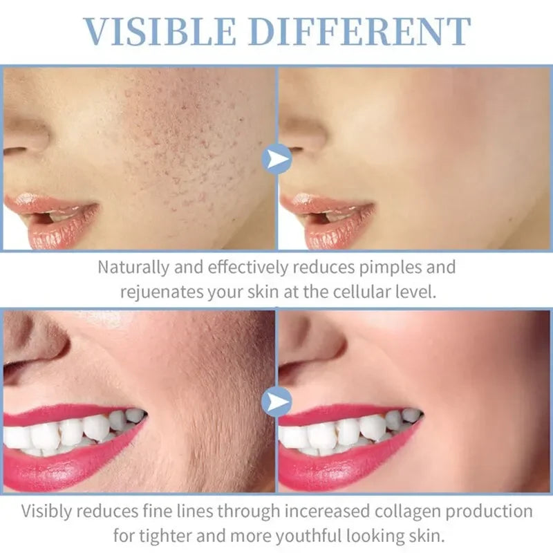 4-in-1 Portable Facial Therapy Wand